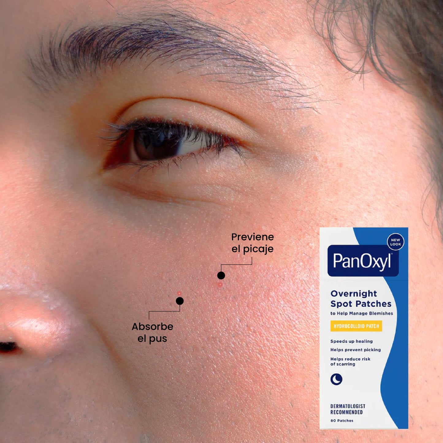 Spot Parches de Noche | Beneficios | Uperfect Perú