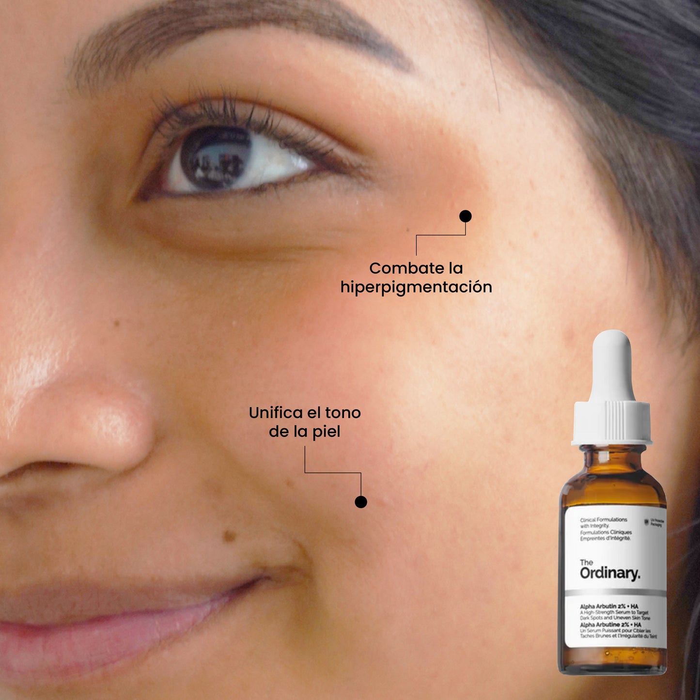 Alpha Arbutin 2% + Ácido Hialurónico | Tratamiento rostro | Uperfect Perú