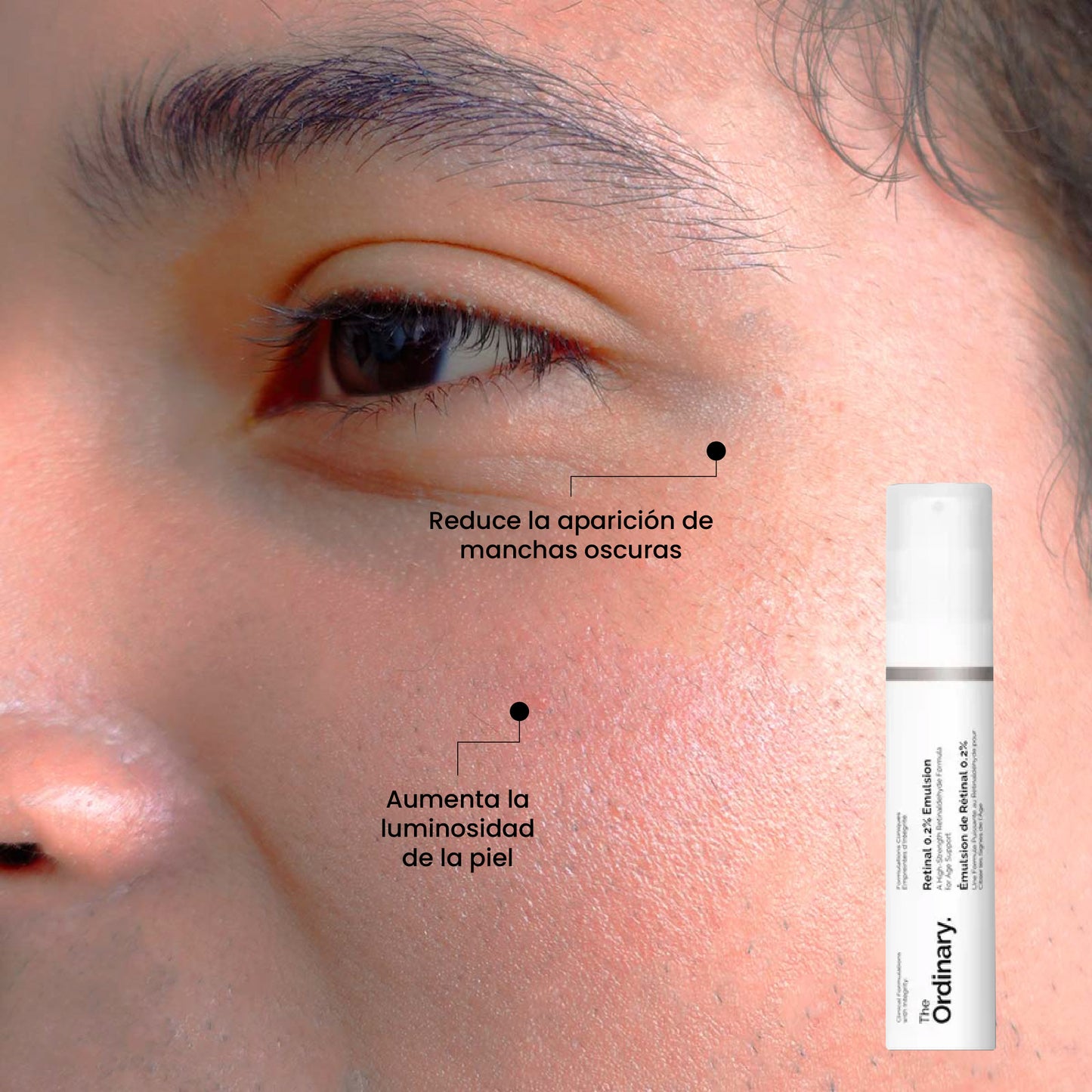 Beneficios | Retinal 0.2% Emulsión | Uperfect Perú