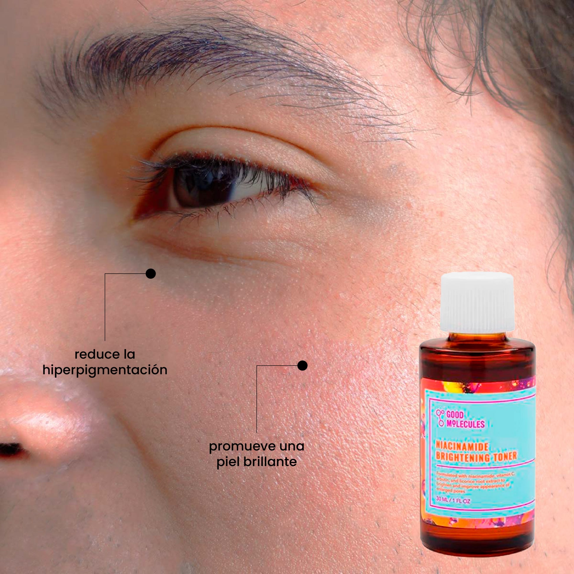 Tónico Iluminador de Niacinamida | Beneficios | Uperfect Perú