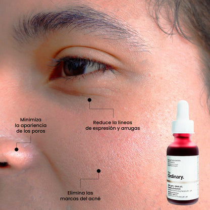 Beneficios | Peeling Solution | Uperfect Perú