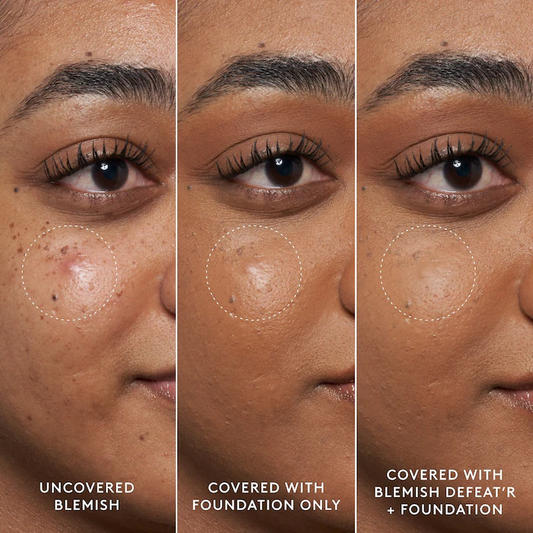 Blemish Defeat'r | Fenty Skin | Uperfect Perú